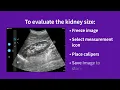 Vscan Air Using presets for evaluations kidney