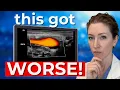 My Arteries Got Older A Vascular Surgeon Explains CIMT Results