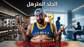 خسرت وزن؟ جلدك هيترهل؟ 🔥 ايه الـ٥ عوامل اللي بتفرق في النتيجة! | ساموي |