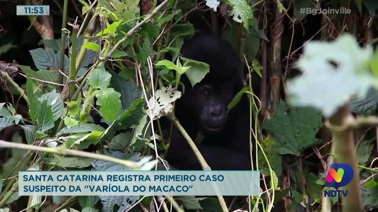 Santa Catarina registra primeiro caso suspeito da "varíola do macaco"