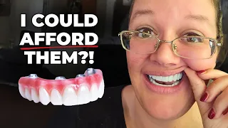 How I Afforded Permanent Teeth in 24 Hours I m Not Rich