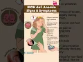 Download Lagu Don't Ignore These IRON DEFICIENCY Anemia Warning Signs