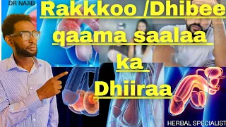 dhibee qaama saalaa ka dhiiraa meeshaa dhiiraa zakar qofarratti rakkoo hedduu dhufa subscribe like
