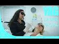 Skin Rejuvenation Experience the Magic of YAG Facial Treatment