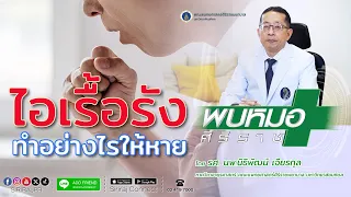 ควรใช้ยาบรรเทาอาการไออย่างไรเมื่อมีอาการไอเรื้อรัง