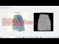 How to do fingerprint enhancement using matlab Fingerprint enhancement matlab project
