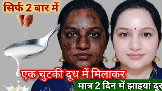 सिर्फ एक चुटकी दूध में मिलाकर सारी Tanning कालापन चली गई,चेहरा साफ गोरा टाइट हुआ🙈