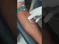 Blood donation procedure।Blood donation needle insertion। Blood collection #short #shorts #ytshorts