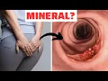 Download Lagu BR. 1 MINERAL ZA SPREČAVANJE RAKA DEBELOG CRIJEVA!