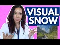 What Is Visual Snow Eye Doctor Explains