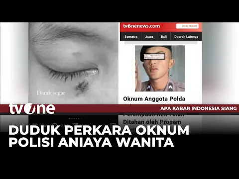 VIRAL! Wanita Posting Luka Penganiayaan oleh Oknum Polisi