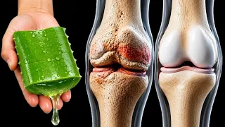 इसे लगा लिया तो 99%घुटनों का दर्द Joint painकमर,हाथ पैर दर्द बिलकुल ठीकknee & back pain
