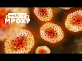 Mpox Explained formerly Monkeypox