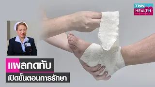 ทำไมผู้สูงอายุจึงมีความเสี่ยงต่อการเกิดแผลกดทับมากกว่าคนอื่น