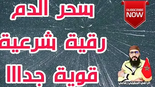 Roqya Char3iya رقية سحر الدم قوية جدا 