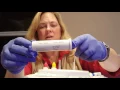 Strep test