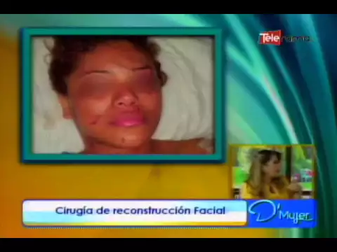 Cirugía de reconstrucción facial