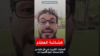 هشاشة العظام Shorts دكريم على 