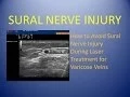 Sural Nerve Injury - How to Avoid The Sural Nerve During Laser Vein Treatment