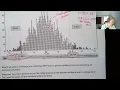 Stat 243 Module 5 3 Bootstrap Confidence Intervals Using Percentiles