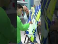 This Brain Injury Turned Him Into A Genius