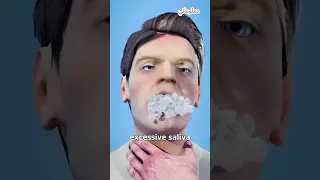 أعراض داء الكلب   موضحة دندنها