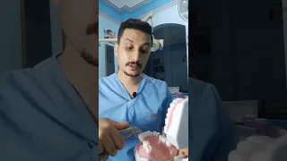 7 تعليمات بعد خلع الضرس حاجات لو معملتهاش بعد الخلع هيحصلك نزيف دكتور عبدالله سلطان الهنداوي 