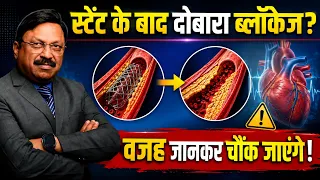 स्टेंट के बाद दोबारा ब्लॉकेज? वजह जानकर चौंक जाएंगे! | Heart Attack After Stent | SAAOL