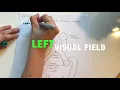 Vision Pathway