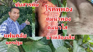 โรคพุพองตุ่มน้ำพองน้ำใสน้ำเหลืองเสียขับสารพิษ@สมุนไพร #โจฮักนะสารคาม #ลุงโจสมุนไพร EP.1772