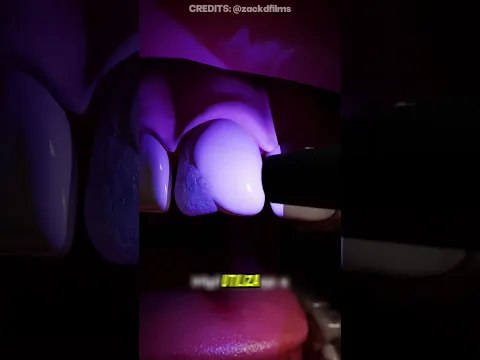 ESTO TE HARÁ EL DENTISTA 😧