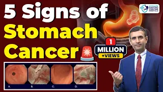 Warning Signs of Stomach Cancer You Shouldn t Ignore Symptoms Diagnosis Awareness
