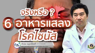  มีอาหารใดบ้างที่คนเป็นไซนัสควรหลีกเลี่ยงจริง ๆ หรือไม่ 