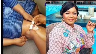 actress bimbo oshin invoved in an unfortunately incident injured few days after her birthday 
