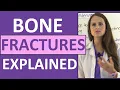 Download Lagu Bone Fractures Types Nursing Interventions, Treatment, Signs and Symptoms NCLEX