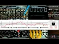 Strange-R Phrase Looping
