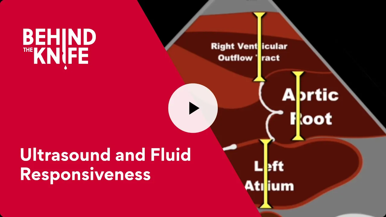 Behind the Knife - Ultrasound and Fluid Responsiveness