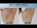 SHIPPING AVAILABLE IPL Hair Removal, Permanent Hair Removal with Sapphire Ice Cooling System, P...