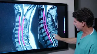 What is Cervical Stenosis? | Jeffrey Cantor, MD