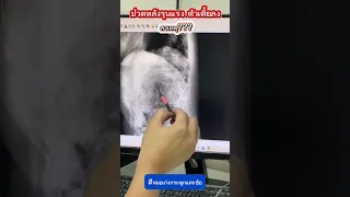  ทำไมคนอายุมากถึงปวดหลังรุนแรง และเกิดจากอะไรบ้าง 