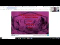 How To Build Unity WebGL and Host It