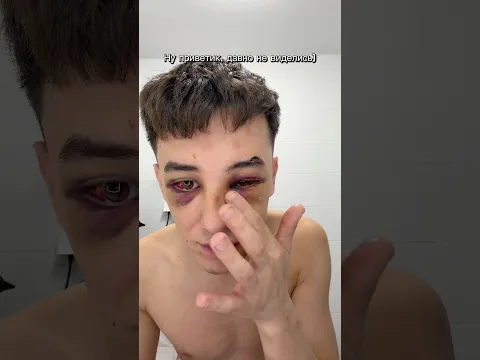 Подрался