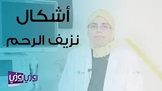 أشكال نزيف الرحم وأسبابه دندنها