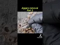 jiggers removal
