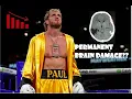 The Truth Behind Logan Paul s Potential Brain Damage