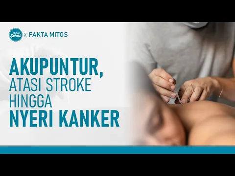 Kenali Akupunktur, Terapi Tusuk Jarum Dengan Berbagai Manfaat
