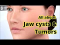 Jaw Cysts Tumors Diagnosis Treatment - Dr Girish Rao
