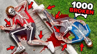 We Broke ALL 1 000 BONES in GTA 5