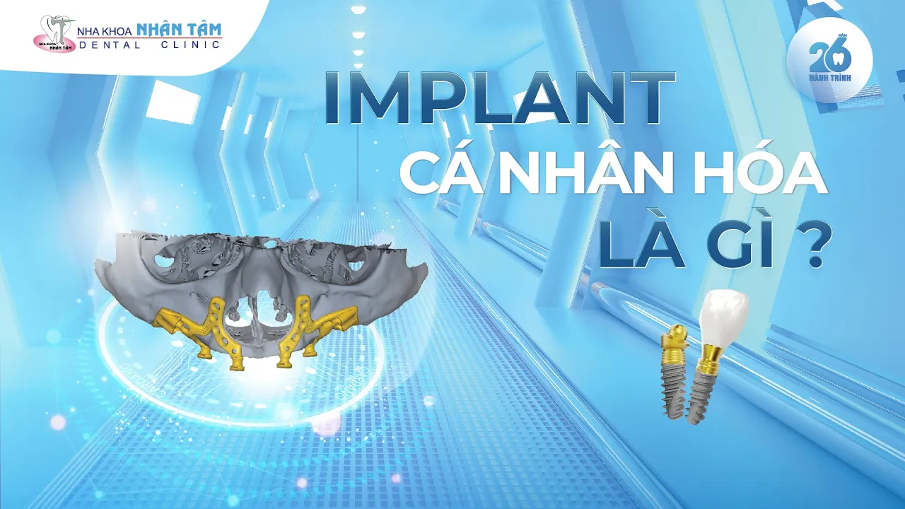 Outline Video Implant Cá Nhân Hóa Là Gì?
