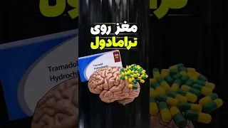 ترامادول دقیقا با مغز چیکار میکنه     دندنها